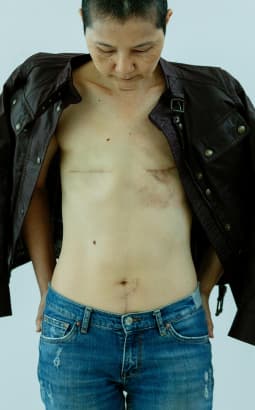 Cancer du sein - cancer_sein_ger_fc