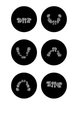 Cone Beam - cone_beam_fc