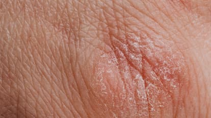 Bannière Diagnostic dermatologique