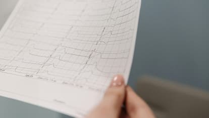 Bannière La prise en charge du risque cardiovasculaire du patient hypertendu