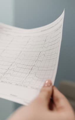 Facteurs de risques cardiovasculaires - facteurs_rcv_mcv_fc
